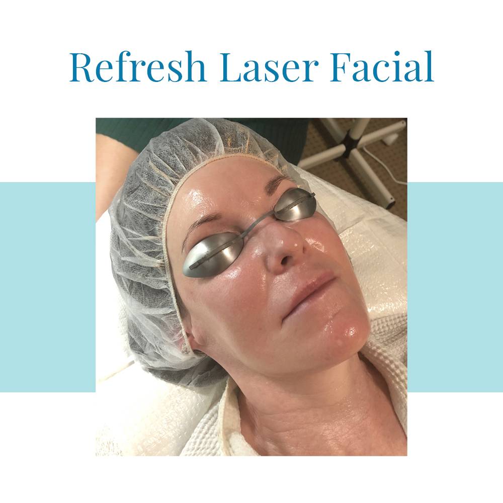 Laser Refresh Facial