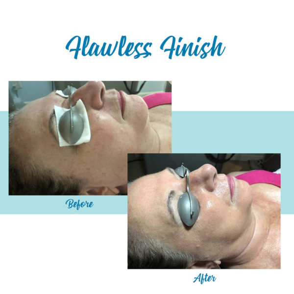 Flawless Finish Makeover