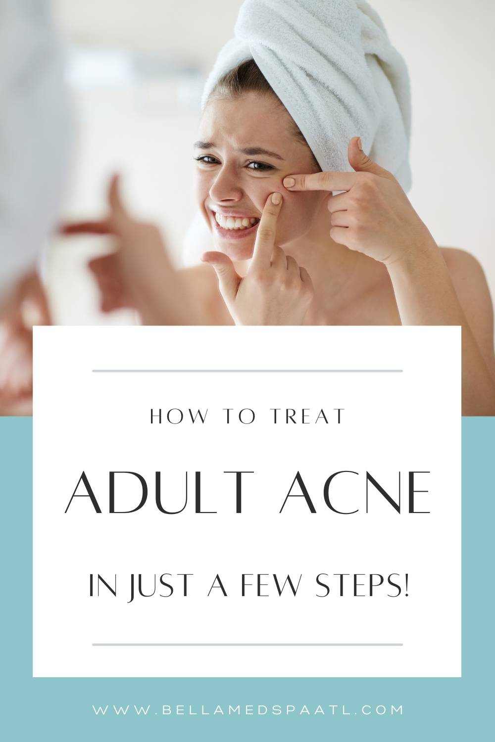 Dealing with adult acne? If you're wondering how to control an acne breakout or how to get rid of acne scars, here are some of the best acne treatments overnight as well as skincare routine steps to tackle acne breakouts and scars!
