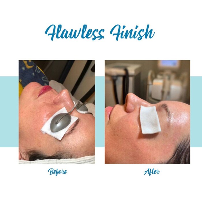 Flawless Finish Makeover