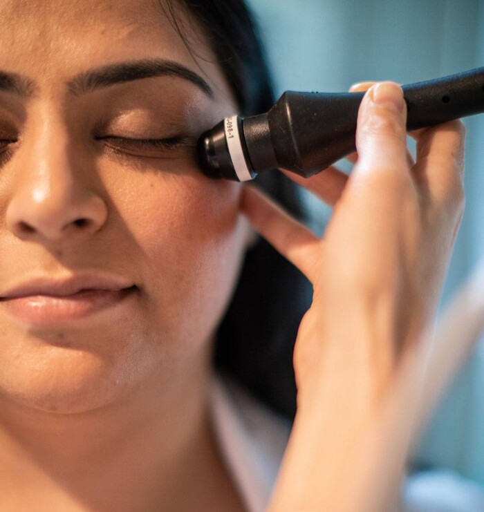 Thermi Eye Lift for skin tightening