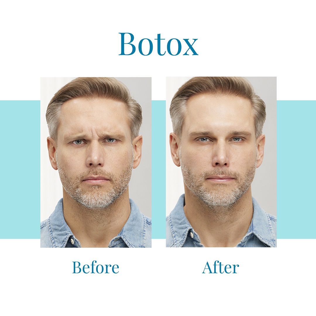 Bella Medspa is the top provider of Botox in Buckhead