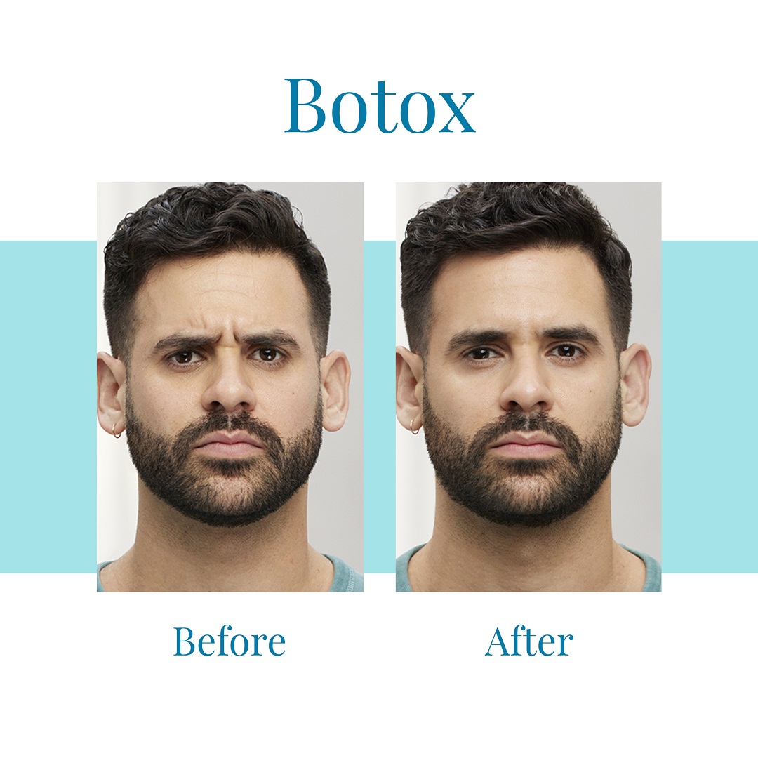 Bella Medspa offers Botox injections in Buckhead